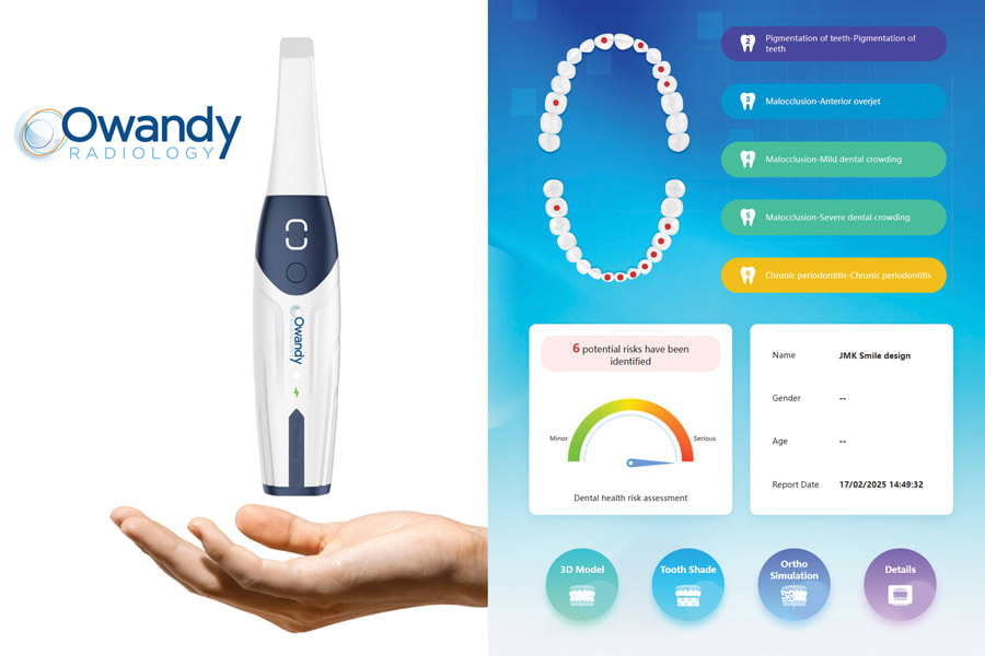 AI-powered Oral Health Report app