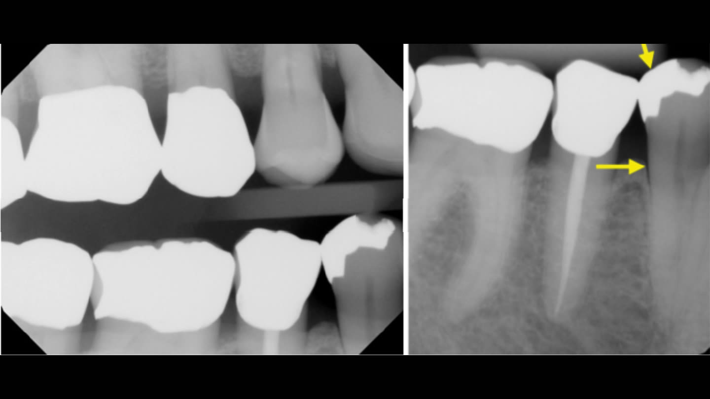 Figure 14