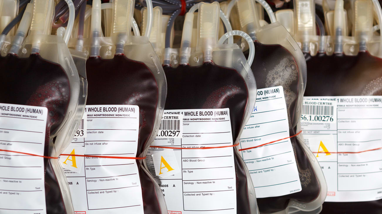 Obstetric Hemorrhage & Hemostatic Resuscitation