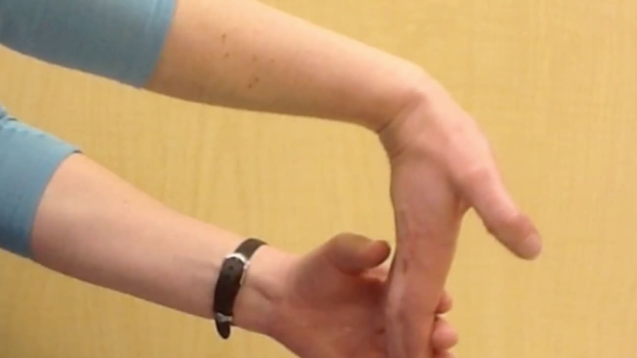 Burns 202: Overview of Stretches