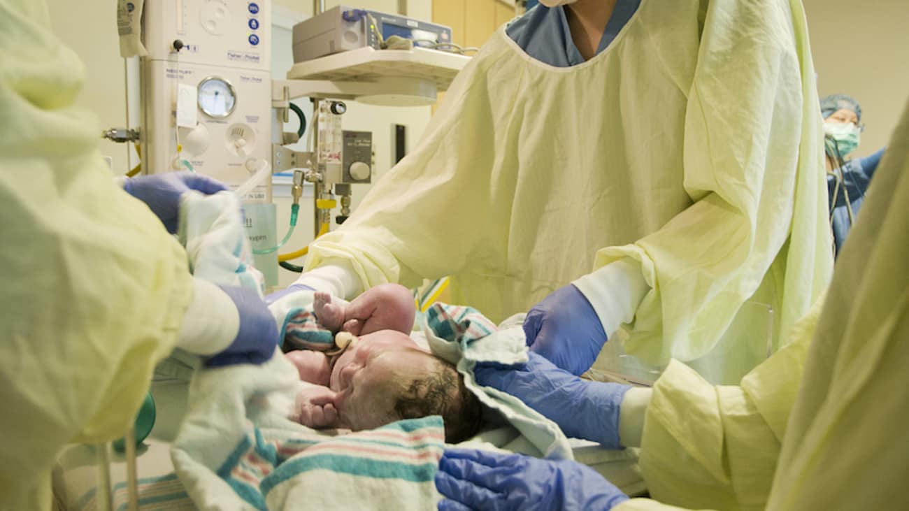 Delayed Cord Clamping for Preterm & Term Infants