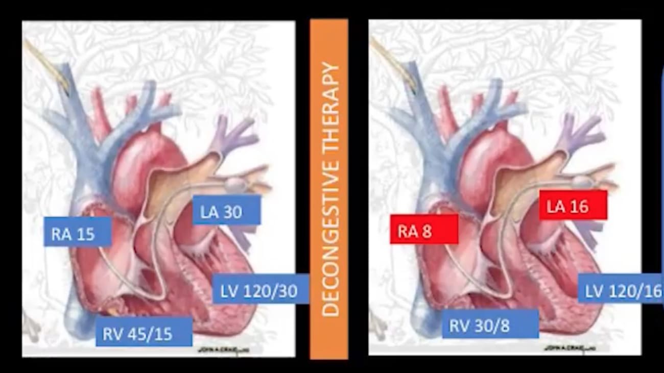 Dr. Lala-Trindade presents Ground Rounds about congestive heart failure