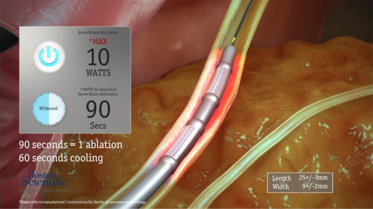 Habib™ EndoHPB Bipolar Radiofrequency Catheter 