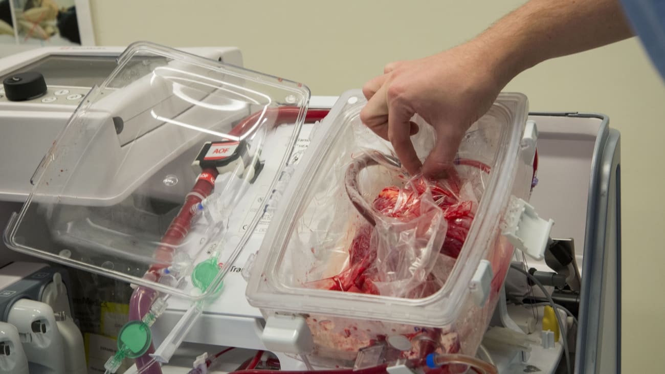 How To Grow Your Heart Transplant Program in 2019