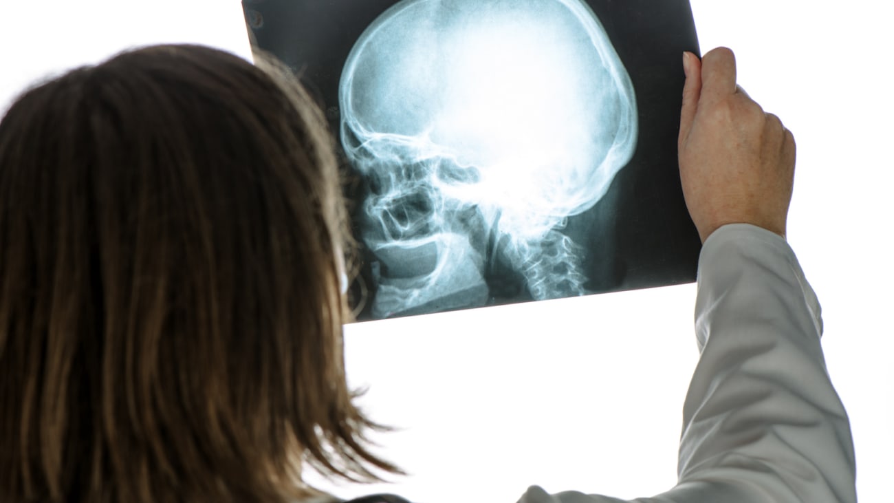 Advances in the Clinical Management and Treatment of Concussion