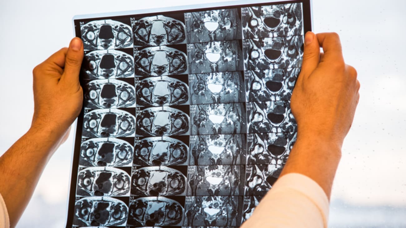 Comprehensive Hip Health: Current Concepts in Diagnosis, Imaging, and Management of Articular Cartilage Pathology
