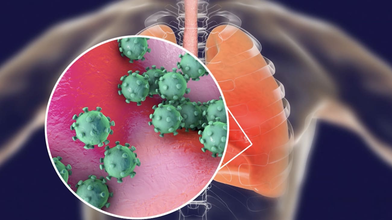 UW Medicine Lab Scientists Study 2019 Novel Coronavirus