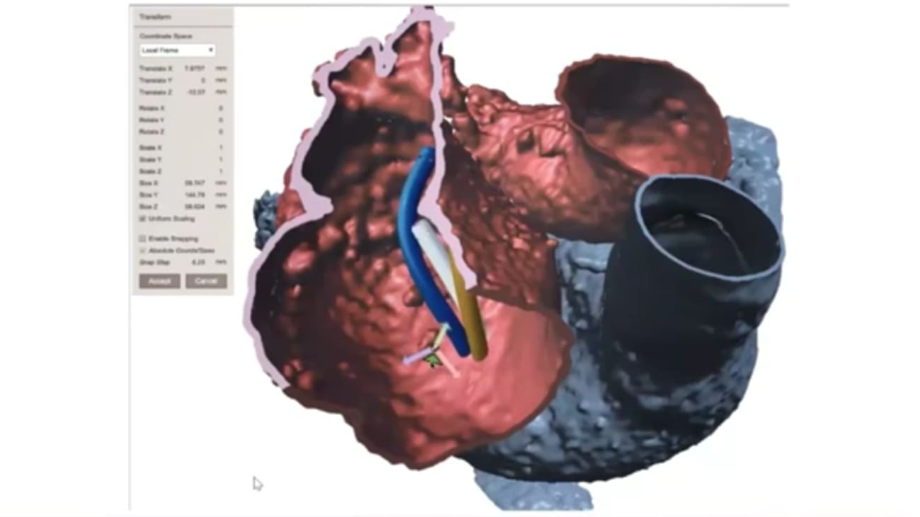 3D Printing and Virtual Planning for Clinical Care Innovation