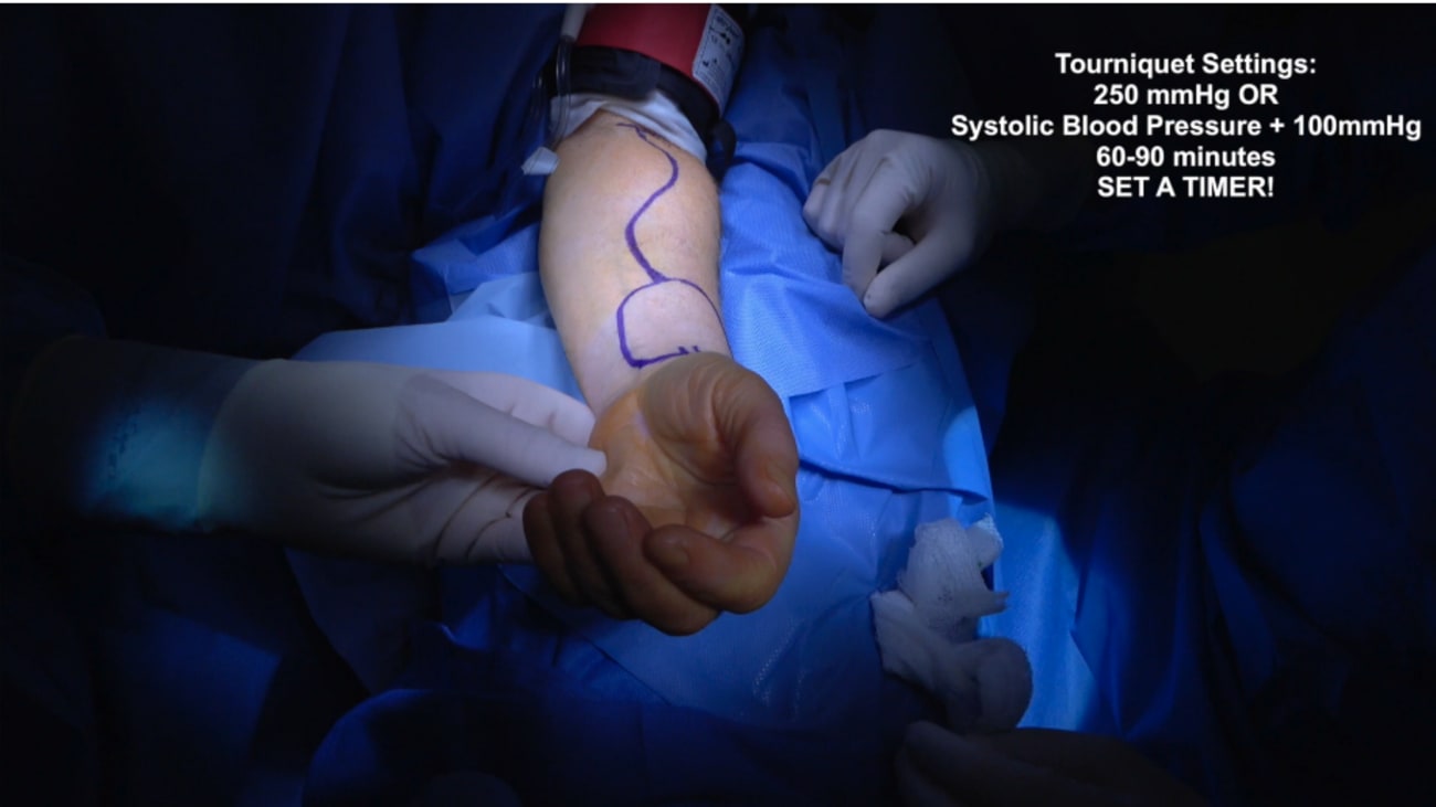 Mount Sinai Otolaryngology Surgical Series: Radial Forearm Free Flap (RFFF) Harvest