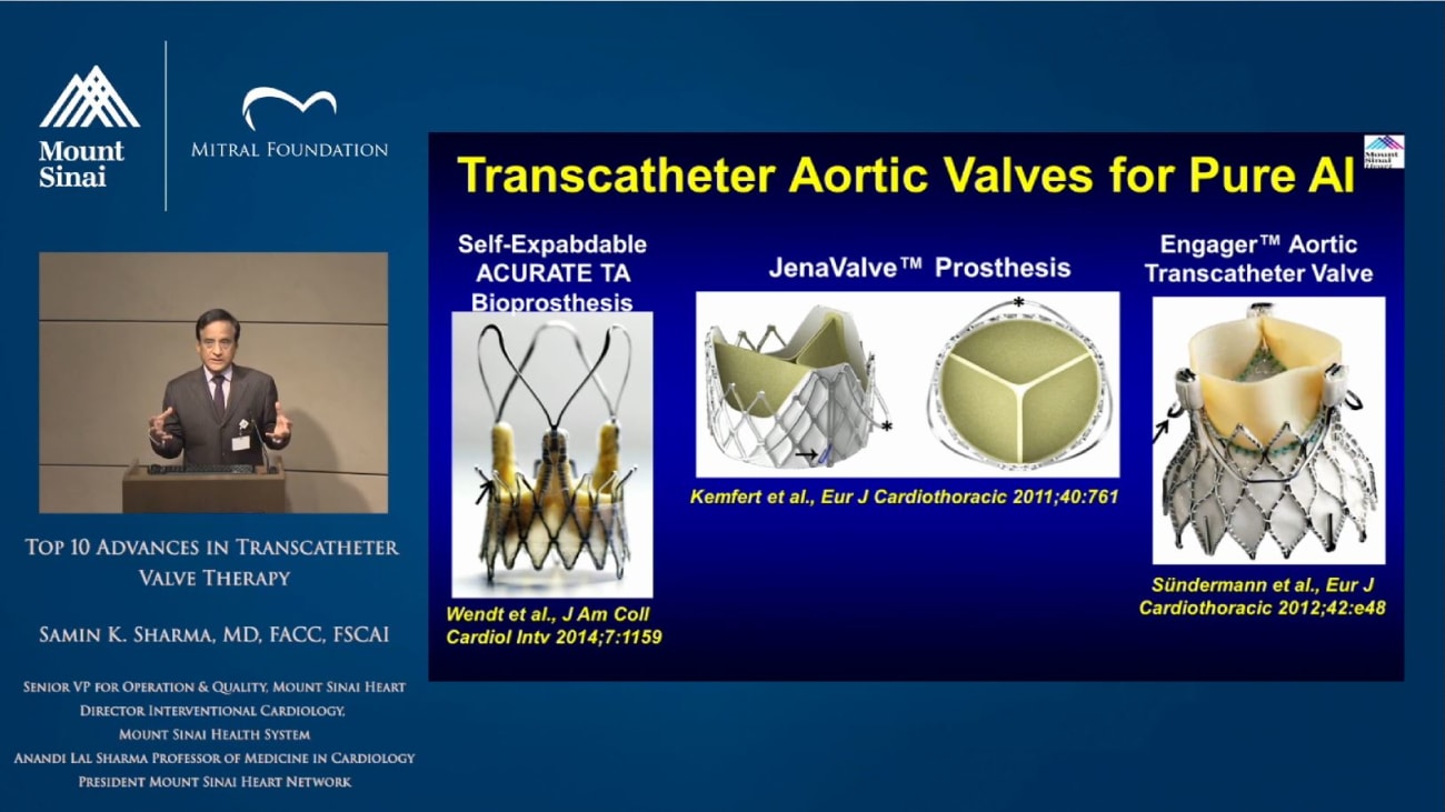 Top 10 Advances in Transcatheter Valve Therapy