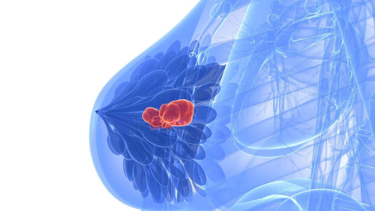 breast imaging breast imaging