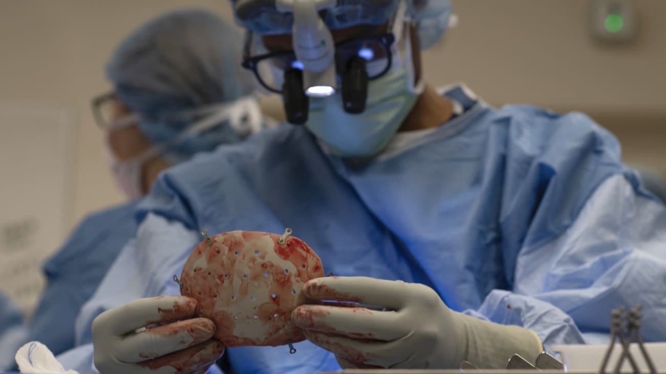 Global Neurosurgical Prosthesis Market 2020 Definition Size Share Segmentation And Forecast Data By 2025 The Courier