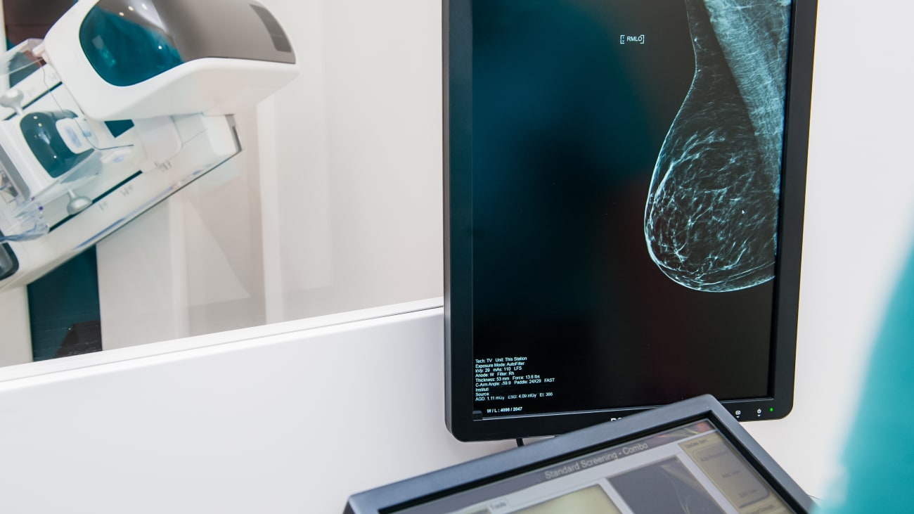 The Future of Breast Imaging at NorthShore BroadcastMed