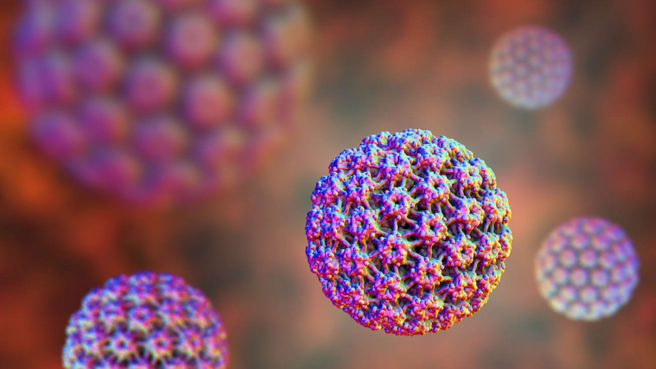 Human Papillomavirus (HPV)-Associated Oropharyngeal Cancer by Daniel L. Miller