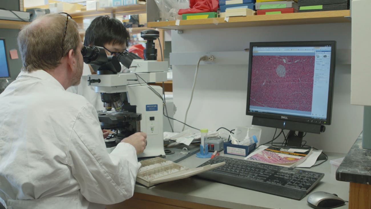 Immunology and Immunotherapy for Pancreatic Cancer A Penn Medicine