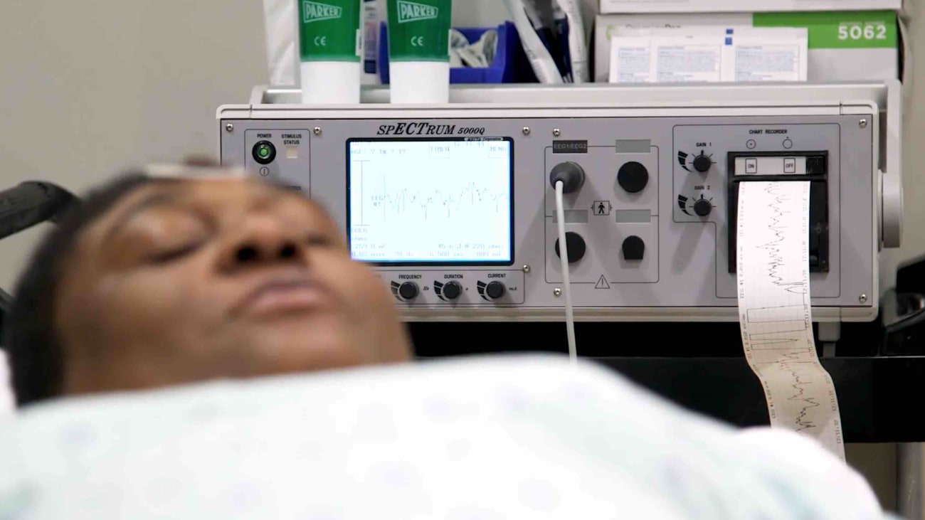 What Is Electroconvulsive Therapy Machine at Savannah Cawthorne blog