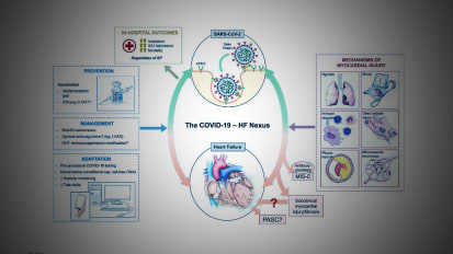 Outline Provides Guidance for Management of Heart Failure Patients During COVID-19 Pandemic