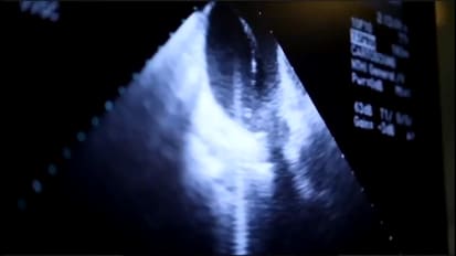 Mount Sinai Adult Congenital Heart Disease Center Earns Accreditation as a Comprehensive Care Center