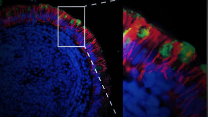 Intestinal Study Yields Insights Into Persistence of SARS-CoV-2