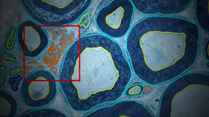 Breakthrough Tool for Assessing Nerve Fibers Is Now Available to Neuroscientists Worldwide