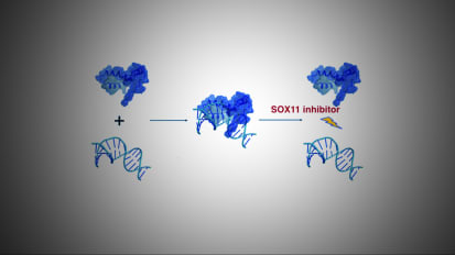 Three Compounds Offer Hope in the Battle Against Mantle Cell Lymphoma