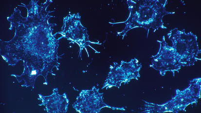 Level of Chromosomal Abnormality in Non-small Cell Lung Cancer May Predict Response to Immunotherapy