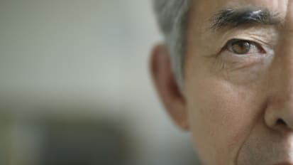 New Insights: Eye Damage in Alzheimer’s Disease Patients