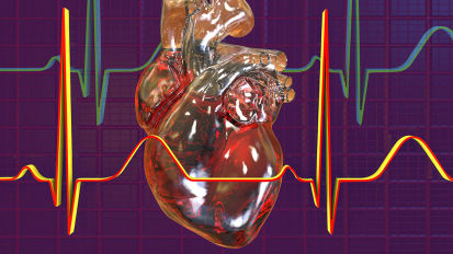 Patients Diagnosed With New-Onset, Persistent AFib Are More Likely to Have These Risk Factors