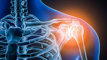 Advances in Shoulder Replacement Surgery: Customization, Durability, and Better Outcomes