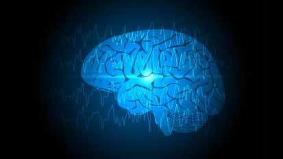 Identifying the Seizure Onset Zone Through Single-Pulse Electrical Stimulation