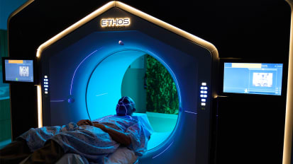 Harnessing the Power of Adaptive Radiation Therapy: A One-Year Review from Fox Chase Cancer Center