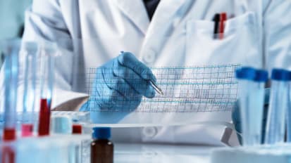 Molecular Analysis Advances Risk Profiling and Assessment of Immunotherapy Response in Smoldering Myeloma