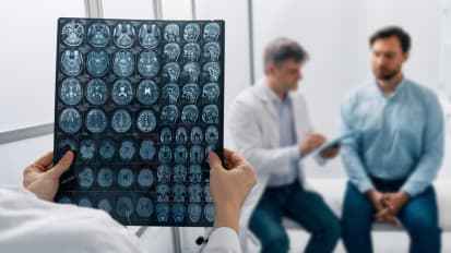 Beyond Stroke: A comprehensive approach to cerebrovascular care