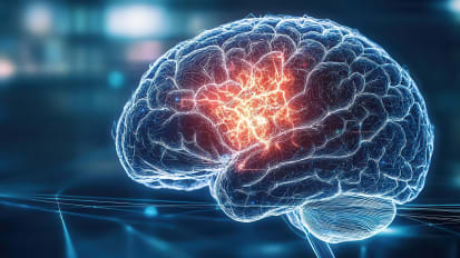 Urgency in action: How research is revolutionizing stroke care