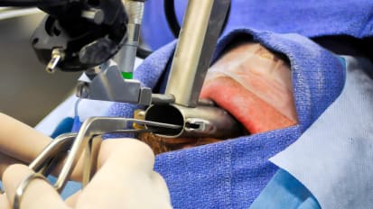 Airway Stenosis Study Focuses on Optimizing Patient Outcomes