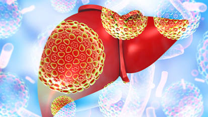 Compound Tested for Alcoholic Liver Disease