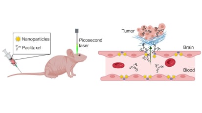 How Nanotechnology Could Change Glioblastoma Treatment