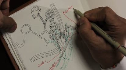 A Pioneering Clinician and Researcher Produces Innovations in Nerve Sparing Techniques to Tailor a Unique Approach for Each Patient