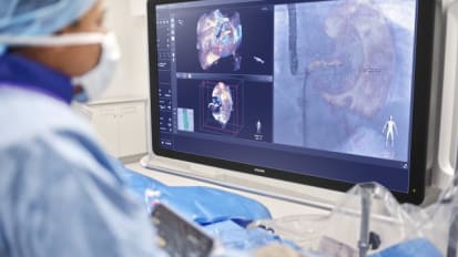 Image-Guiding Software Advances Heart Valve, Cath Lab Procedures