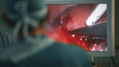 Liver Surgery: Minimally Invasive Techniques Can Be an Option