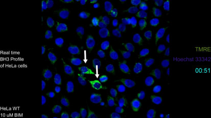 Live Cell Imaging IDs Bad Actors in Cancer and Finds Possible Ways to Defeat Them 