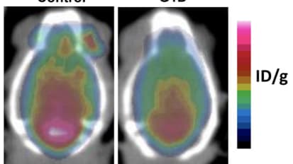 UTSW Scientists Identify Brain Circuit That Triggers Rare, Blood Sugar-dependent Epilepsy