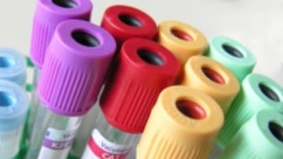 Researchers Use Machine Learning to Identify Autism Blood Biomarkers