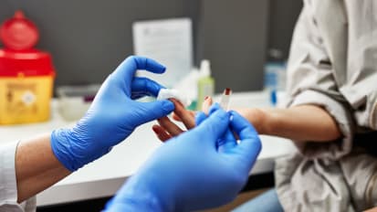 Can a Simple Blood Test Measure Fracture Recovery?