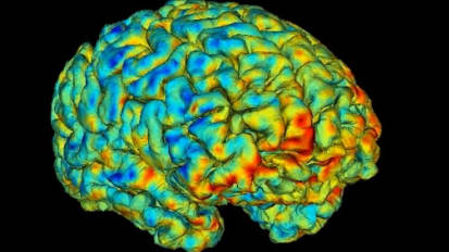 UTSW-led Research Identifies New Imaging Biomarkers that Predict Antidepressant Response