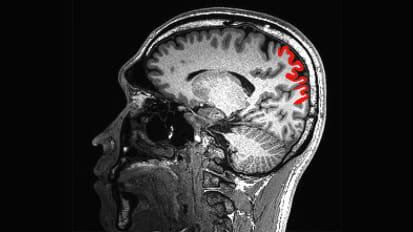 Lifelong physical activity may slow cognitive decline