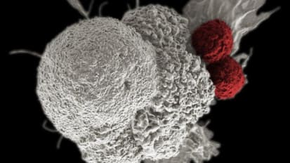 Response to Cancer Immunotherapy May Be Affected by Genes We Carry from Birth