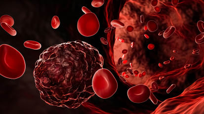 Blood Test Combined With PET-CT Technology Shows Promise in Early Cancer Detection