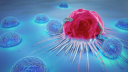 Making Anal Cancer Screening a Priority for High-Risk Patients