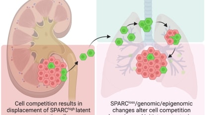 Cell Competition May Explain Cancer Relapses, Research Suggests